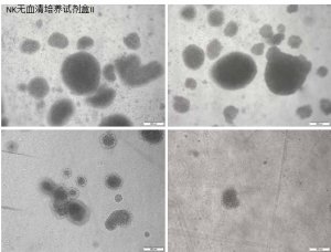 使用Corning? NK細(xì)胞無(wú)血清培養(yǎng)試劑盒II 高效地激活和擴(kuò)增人類(lèi)自然殺傷細(xì)胞 應(yīng)